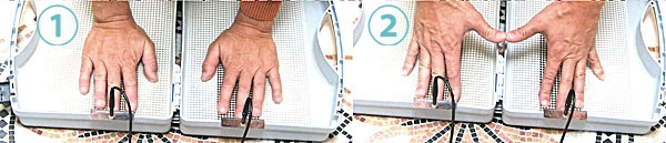 Handbehandlung Iontophorese: Gerät kurzschliessen, beide Hände in der Wanne